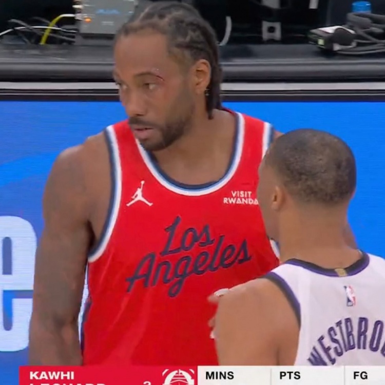 开云体育全站app下载地址-小卡眼角被打破血流不止 回更衣室治疗之后已经重回球场